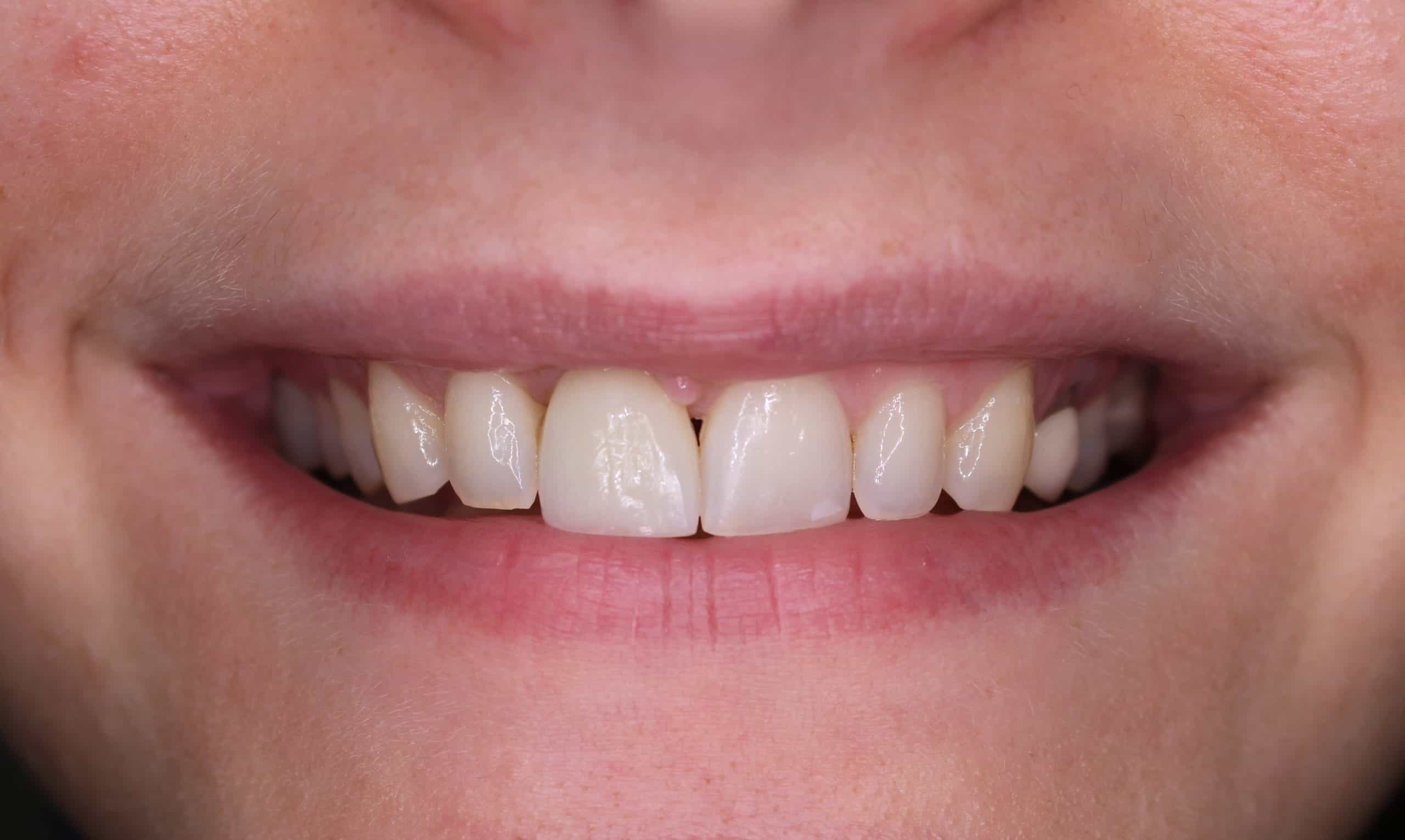 Dentist sumner park killoran dental sumner qld 4074